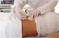 Doğum Sonrası Selülit Belirtileri ve Tedavisi