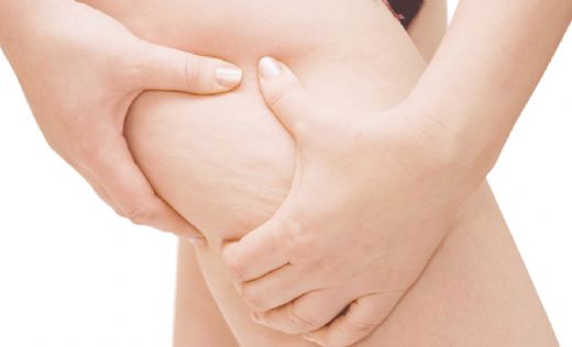 Selülit Aleti Kullanımı ve Faydaları Nelerdir?