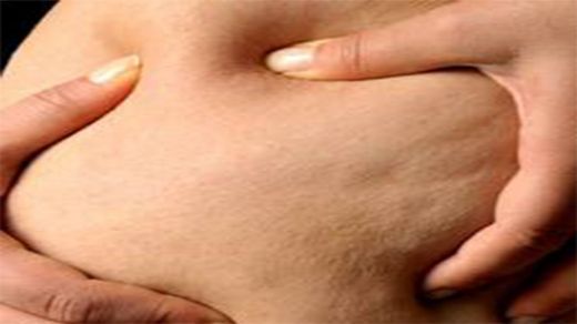 Selülit Bandı Kullanımı ve Faydaları Nelerdir?